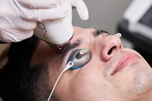 Resurfacing Laser - JECT