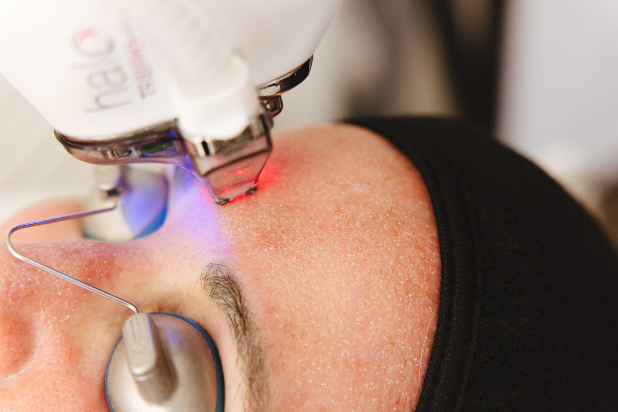 Halo Tribrid Laser JECT New York NYC West Village